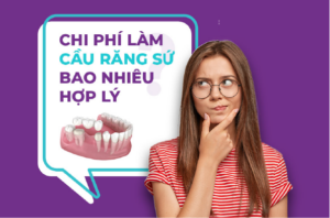 Chi phí làm cầu răng sứ