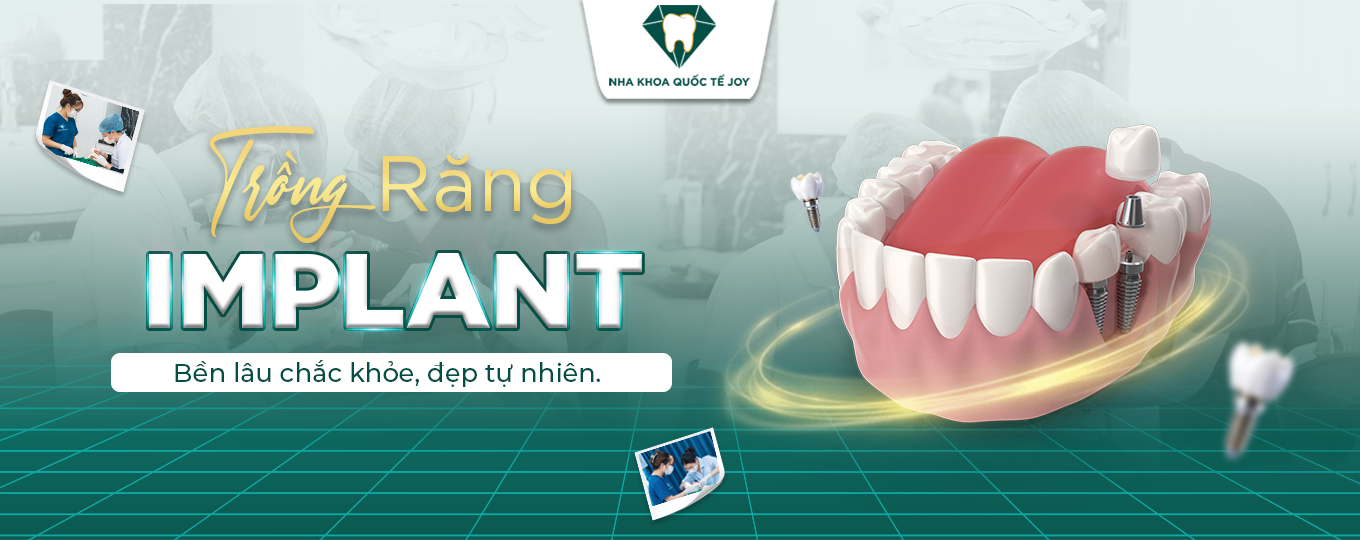 Trồng răng implant