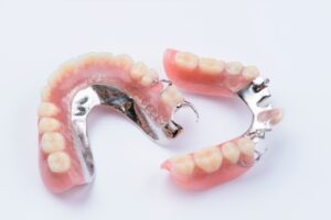 Răng giả tháo lắp bằng kim loại