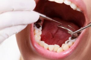 Tình trạng sức khoẻ răng miệng