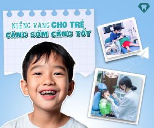 Trẻ em có thực sự cần phải niềng răng sớm không?