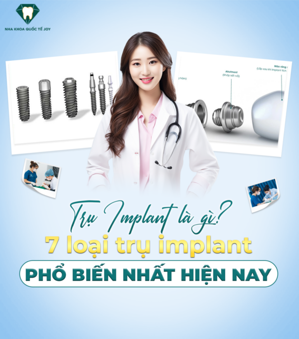 Trụ impalnt là gì? 7 loại trụ phổ biến