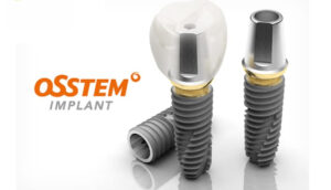 Trụ implant Osstem là gì