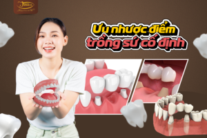 Ưu và nhược điểm trồng răng cố định