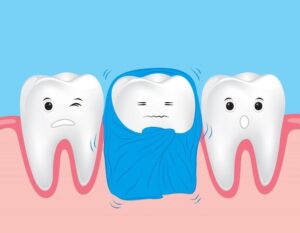 các vấn đề về răng miệng