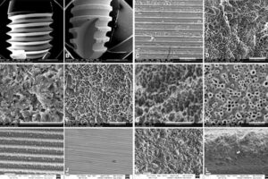 Các công nghệ xử lý bề mặt độc quyền của trụ implant Mỹ