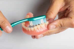 Cách vệ sinh hàm tháo lắp trên implant