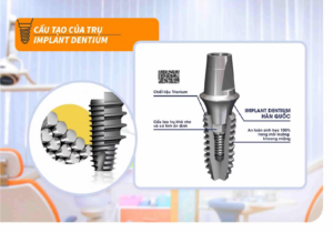 Cấu tạo trụ impant Dentium