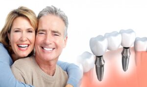 Đối tượng thích hợp với phương pháp implant