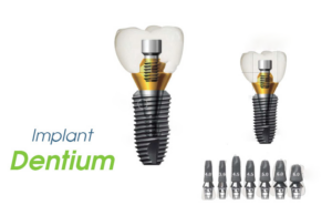 Dòng trụ implant Hàn Quốc Dentium