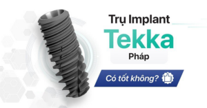 Những ưu điểm vượt trội của trụ implant Tekka