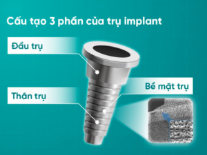 cấu tạo của trụ implant