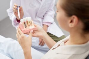 Ưu điểm của trụ implant Dentium