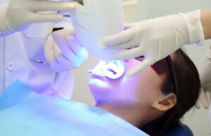Phương pháp tẩy trắng răng bằng đèn LED hoặc đèn laser tại nha khoa