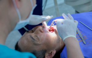 Nhổ răng khôn có đau không tuỳ thuộc vào cơ địa mỗi người