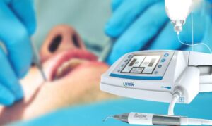 Nhổ răng khôn hàm dưới với phương pháp công nghệ sóng siêu âm