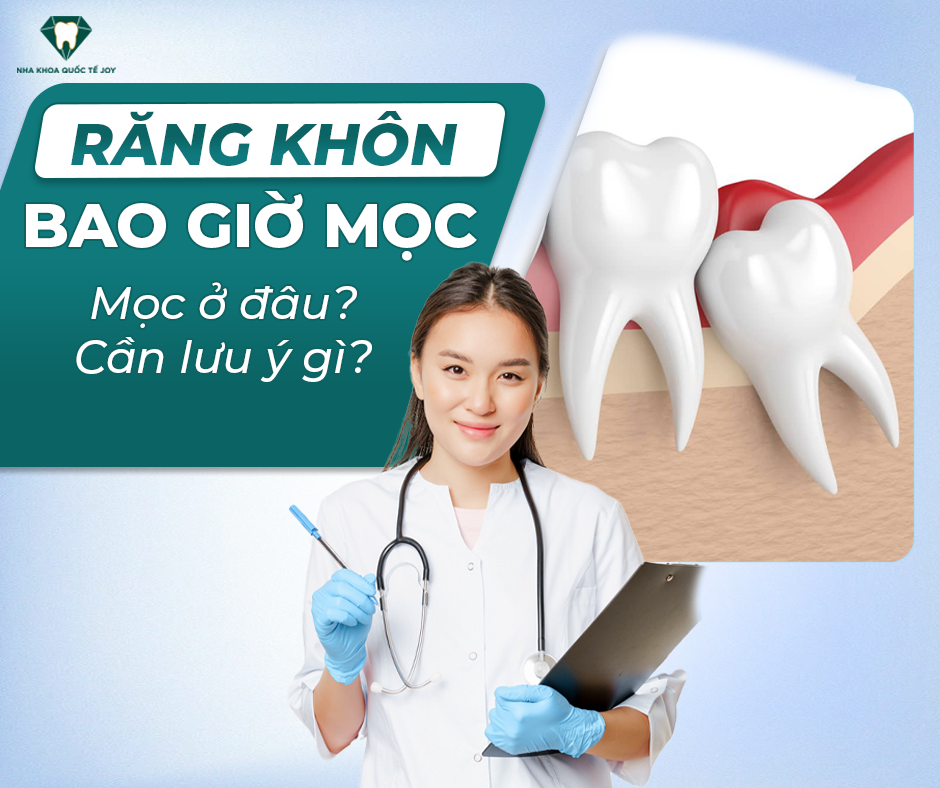 Răng khôn bao giờ mọc