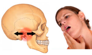 Tổn thương đến khớp thái dương