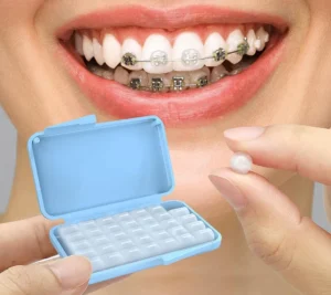 Bạn cần lưu ý gì khi sử dụng sáp nha khoa